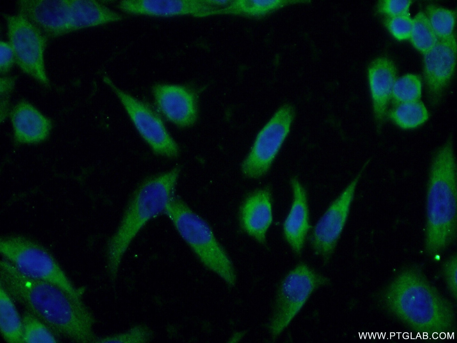 21016-1-AP;HeLa cells