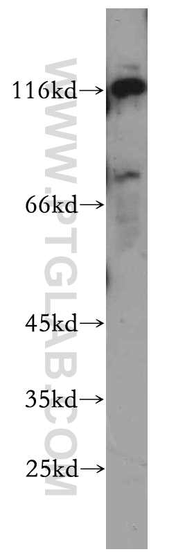 21016-1-AP;HeLa cell