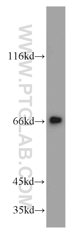 20959-1-AP;mouse brain tissue