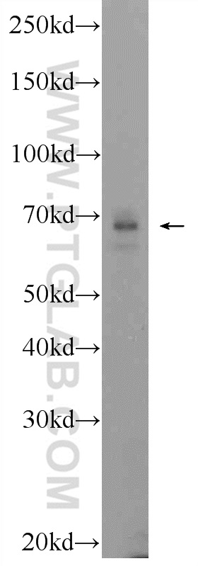 24770-1-AP;PC-3 cells