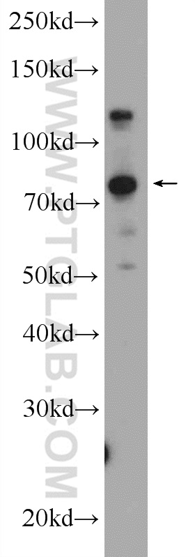 25054-1-AP;Raji cells