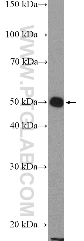 20945-1-AP;HeLa cells