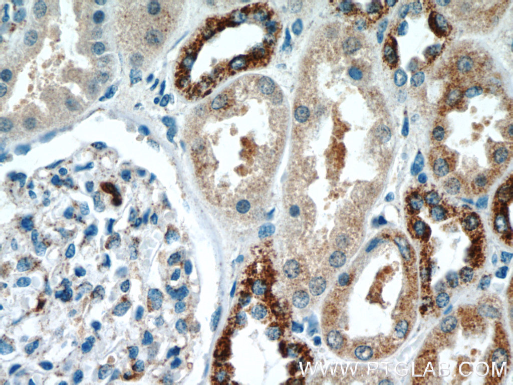 12035-1-AP;human kidney tissue