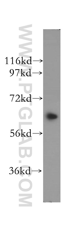 12035-1-AP;Y79 cell