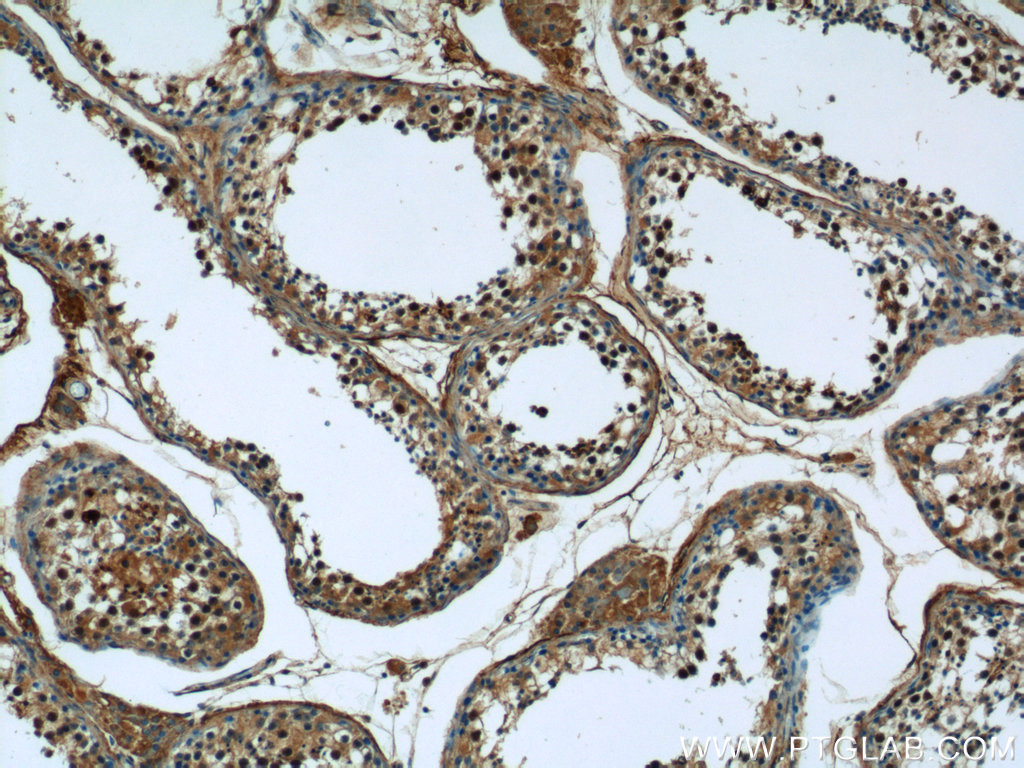 20790-1-AP;human testis tissue