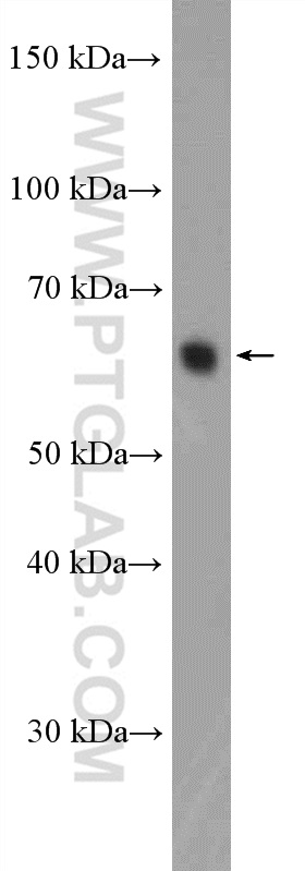 20790-1-AP;rat testis tissue