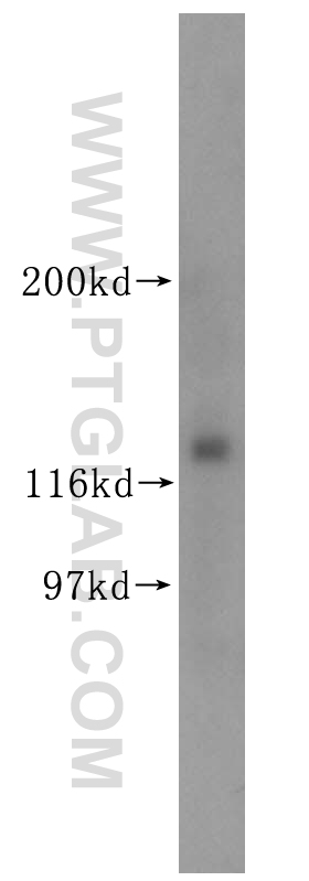 18055-1-AP;mouse testis tissue