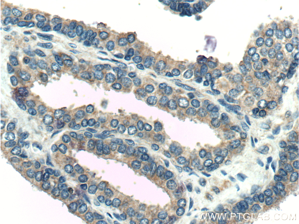 26547-1-AP;human prostate hyperplasia tissue