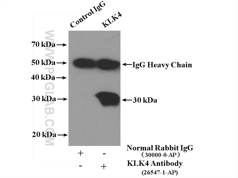 26547-1-AP;DU 145 cells