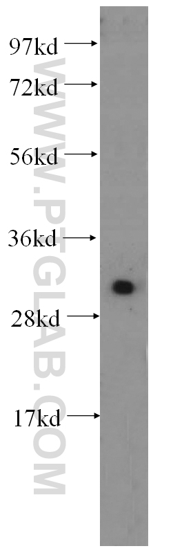 14232-1-AP;HeLa cells