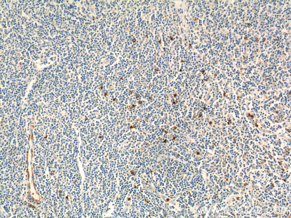 21510-1-AP;human tonsillitis tissue