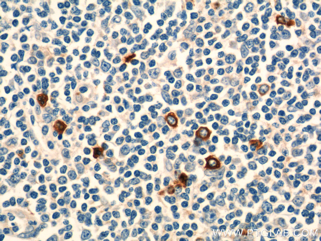 21510-1-AP;human tonsillitis tissue