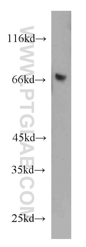 21510-1-AP;human spleen tissue