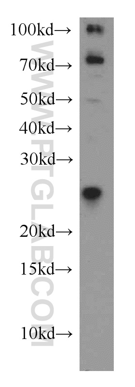 16156-1-AP;SH-SY5Y cell