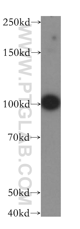 17097-1-AP;HepG2 cells