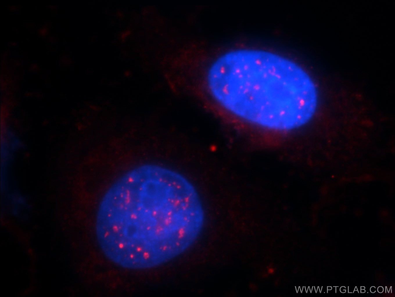 20344-1-AP;HeLa cells