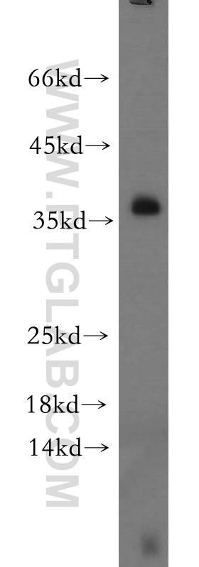 11326-1-AP;Jurkat cells