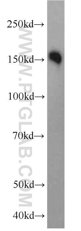 10785-1-AP;mouse brain tissue