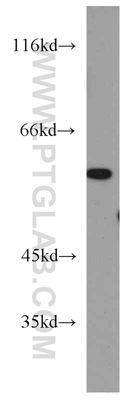 16295-1-AP;Y79 cell