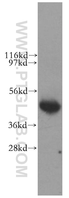 11577-1-AP;human brain tissue