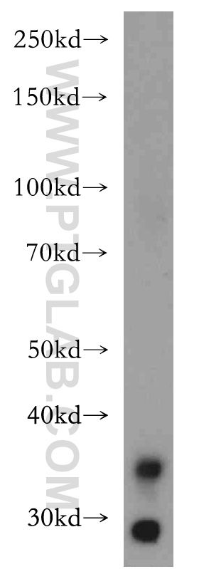 20772-1-AP;human kidney tissue