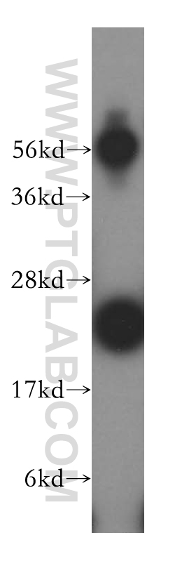 16797-1-AP;HeLa cell