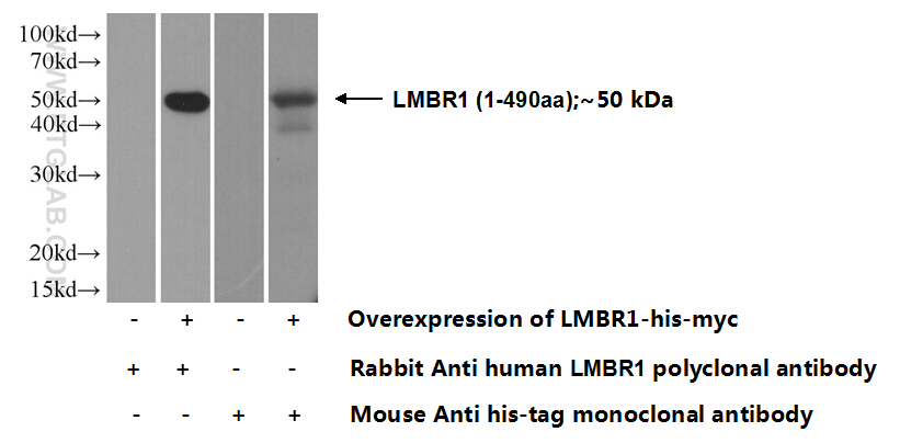 12914-1-AP;Transfected HEK-293 cells