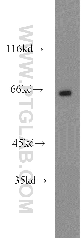 14948-1-AP;human heart tissue