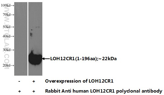 17169-1-AP;Transfected HEK-293 cells