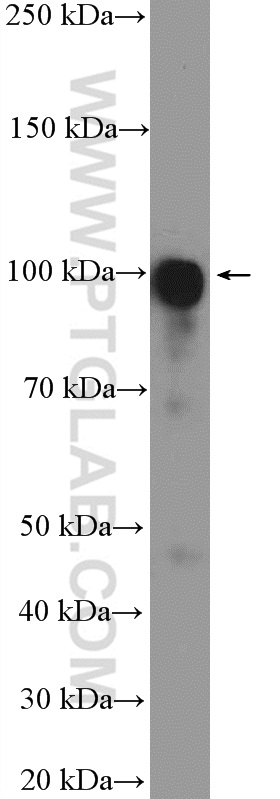 18035-1-AP;Jurkat cells