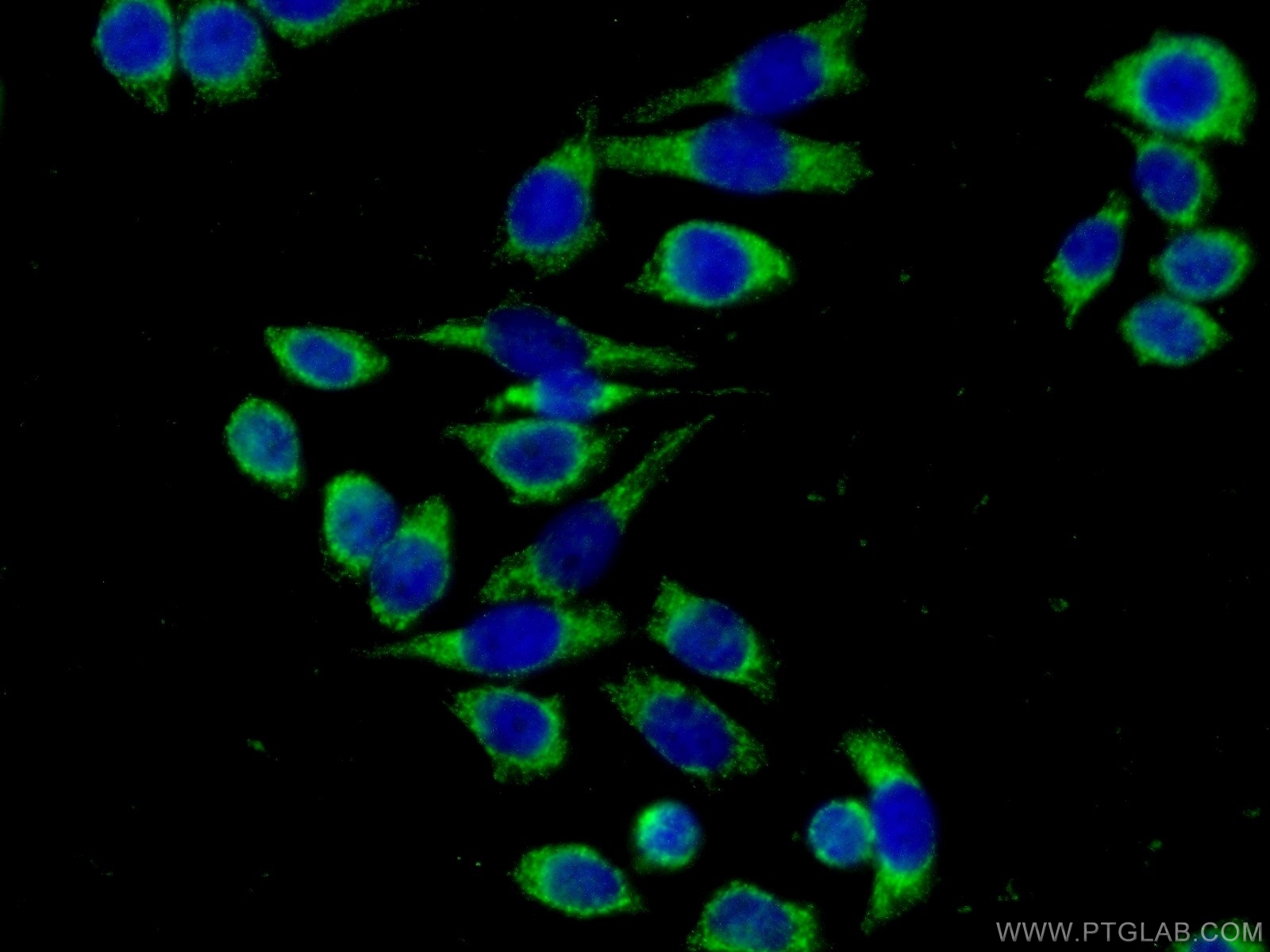 11307-1-AP;PC-3 cells