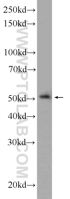 11307-1-AP;PC-3 cells