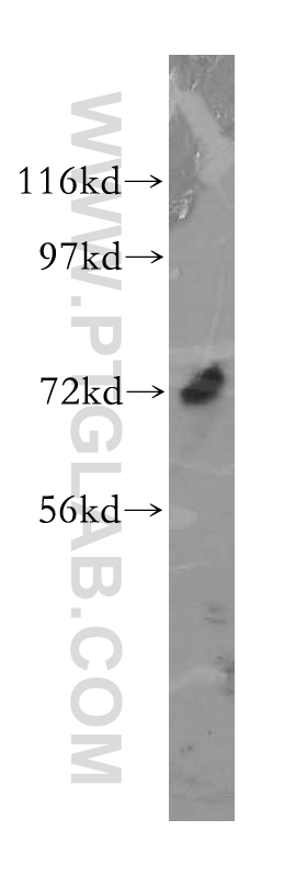 13845-1-AP;Y79 cells