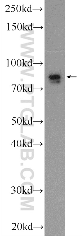 19546-1-AP;human testis tissue