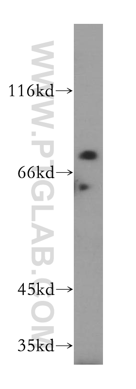 17750-1-AP;HeLa cell