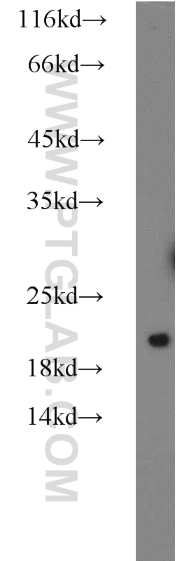 10259-1-AP;HeLa cells