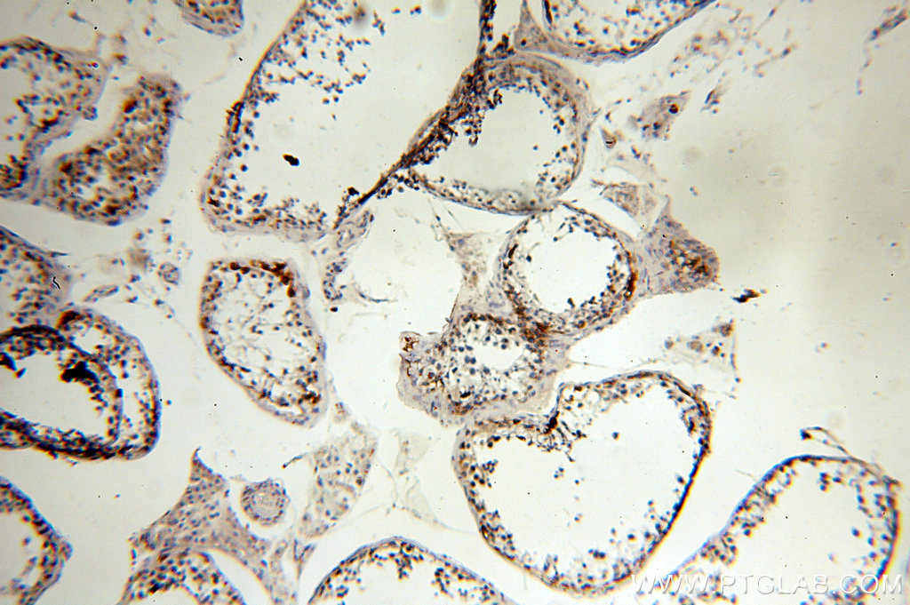 12233-1-AP;human testis tissue