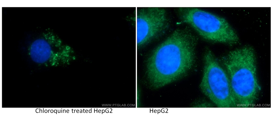 14600-1-AP;Chloroquine treated HepG2 cells
