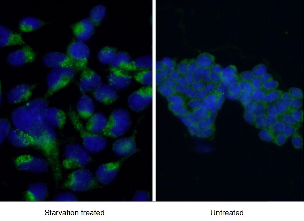 14600-1-AP;Starvation treated HEK-293 cells