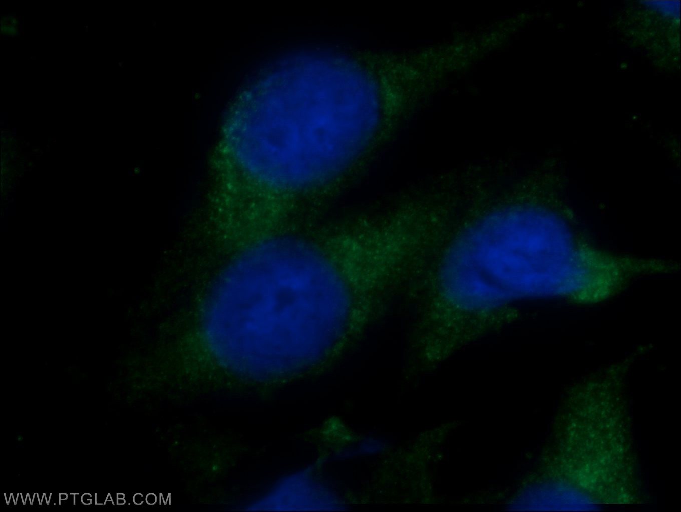 18726-1-AP;Chloroquine treated HepG2 cells