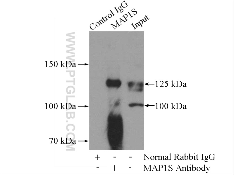 15695-1-AP;SH-SY5Y cells