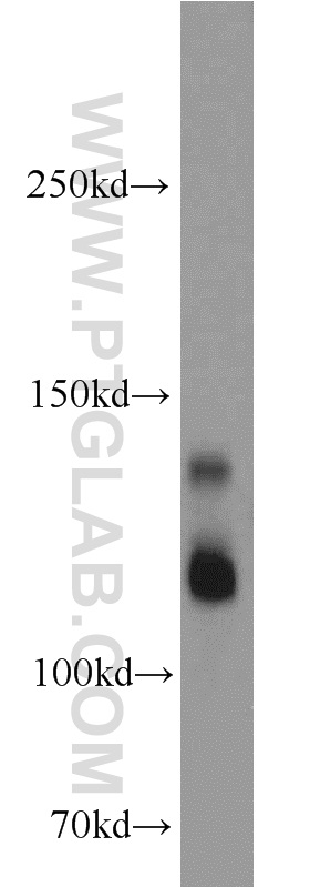 15695-1-AP;human brain tissue