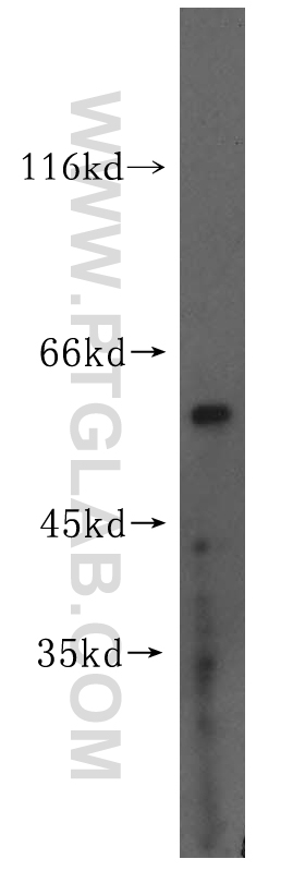 15758-1-AP;HeLa cells