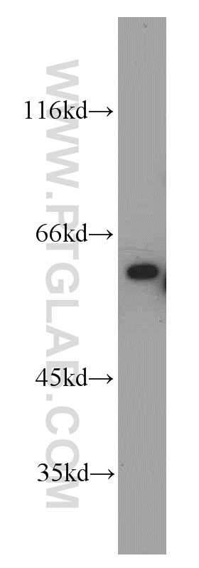 11996-1-AP;PC-3 cell