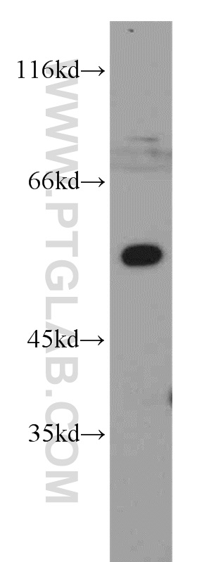 14819-1-AP;K-562 cell