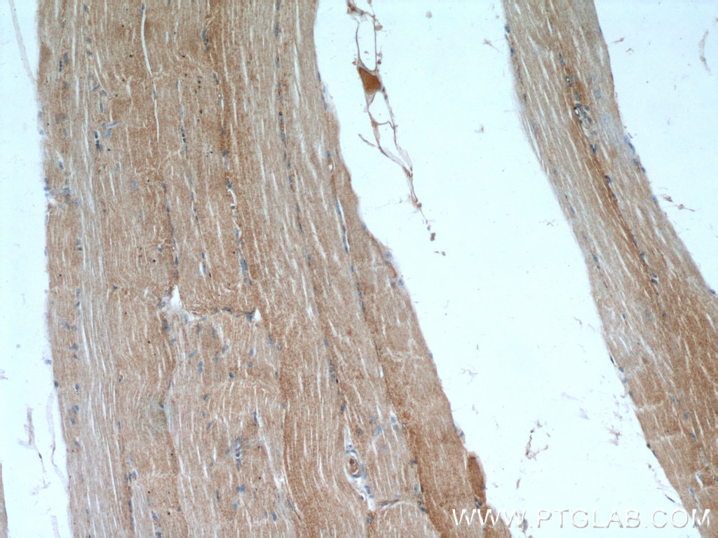 14702-1-AP;human skeletal muscle