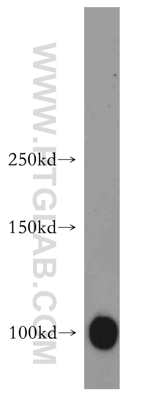 14702-1-AP;human skeletal muscle tissue