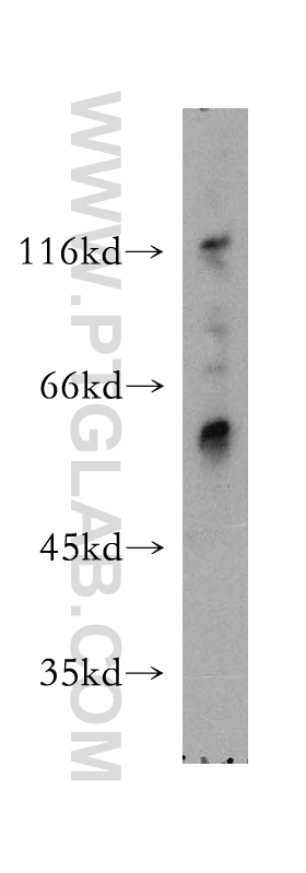 12827-1-AP;mouse ovary tissue