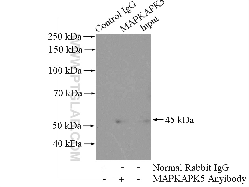 14339-1-AP;HeLa cells