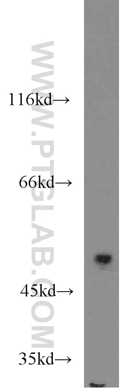 14339-1-AP;HeLa cells